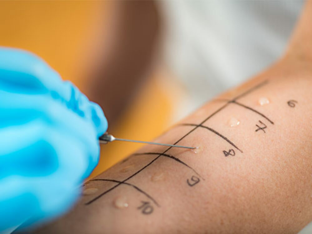 Allergologie - Dermatologie am See