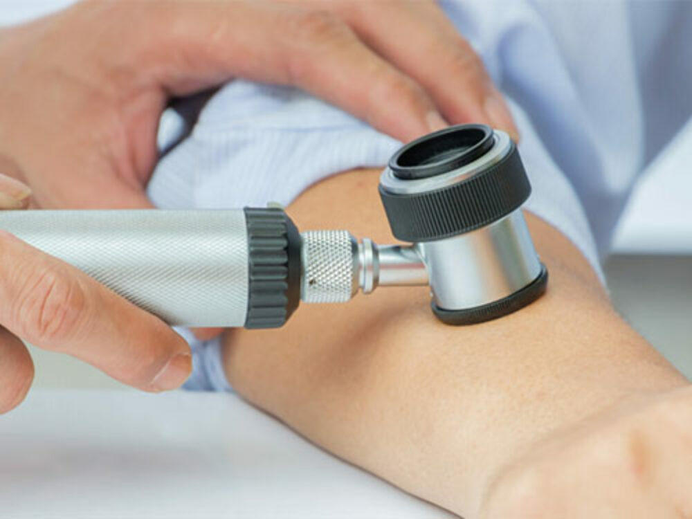 Hautkrebs - Diagnose & Therapie in der Dermatologie am See