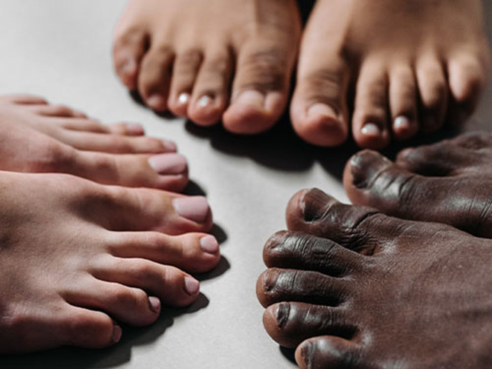 Zehen und Nägel die zu Nagelerkrankungen neigen