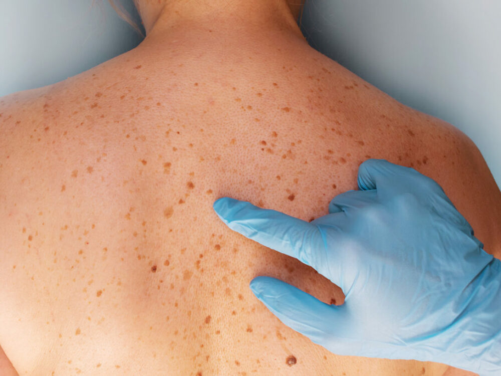 Dermatologie - Hautarzt Feldmeilen
