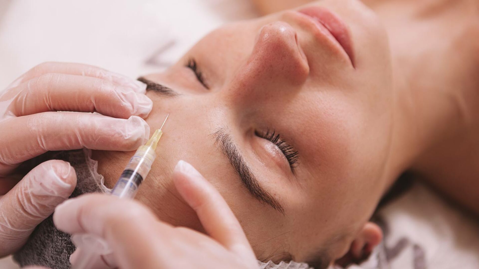 Faltenbehandlung mit Botox(Botulinumtoxin) beim Hautarzt