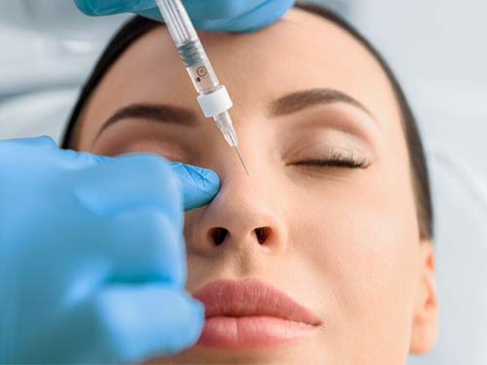 Faltenbehnadlung mit Hyaluron - Ästhetik beim Hautarzt in Feldmeilen