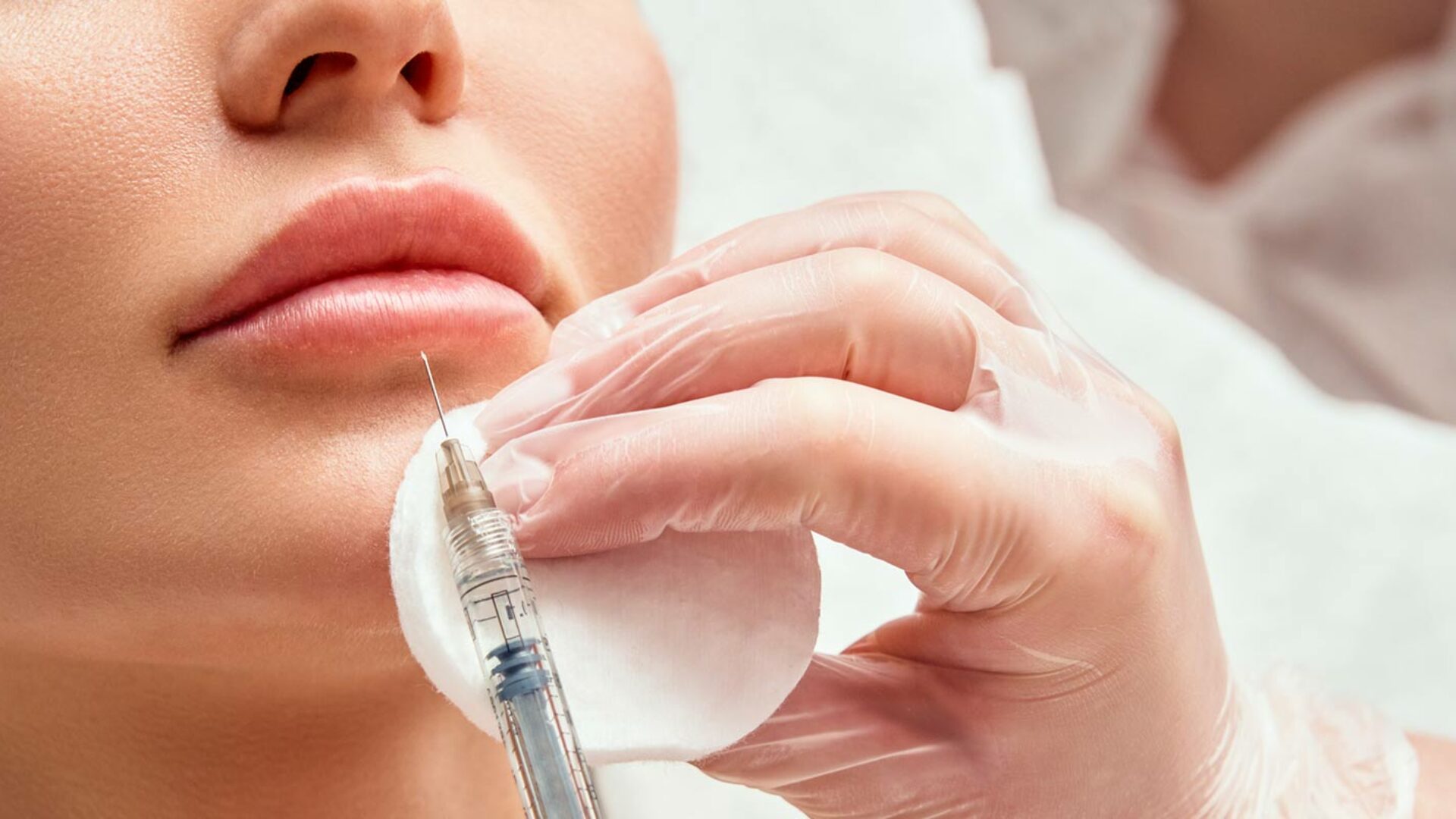 Faltenbehandlung mit Hyaluron bei Ihrem Hautarzt