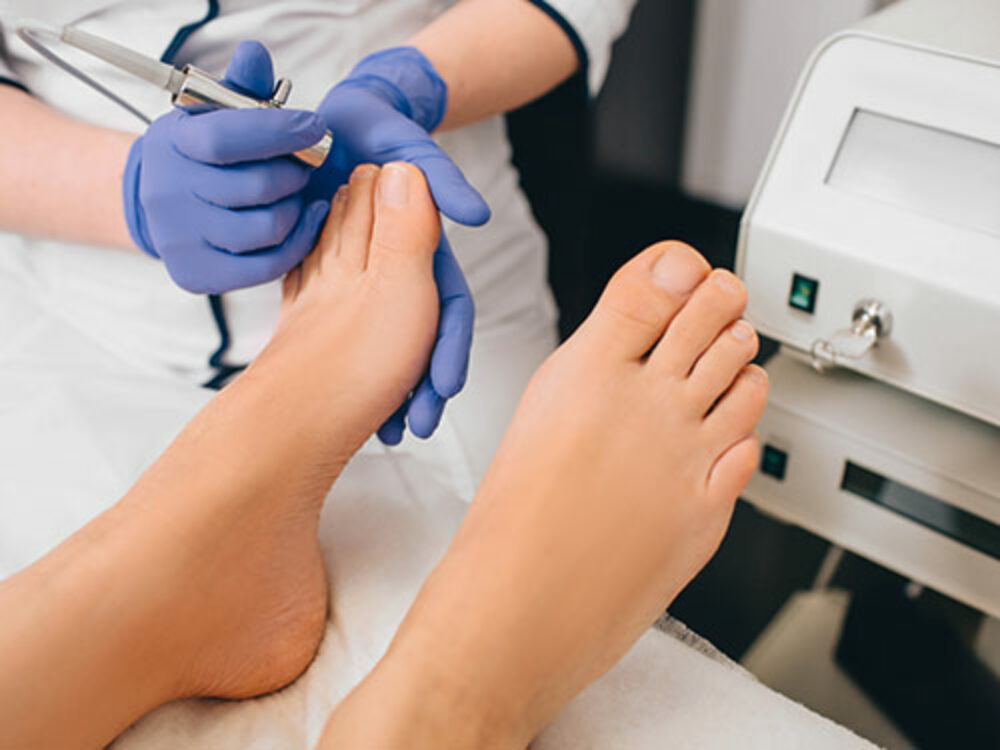 Nagelerkrankungen behandeln in der Dermatologie am See