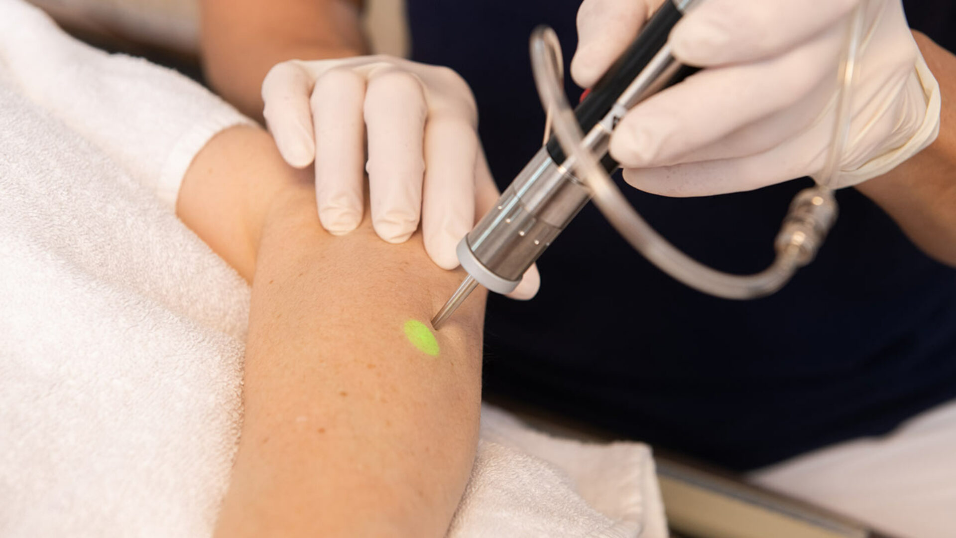 Lasertherapie - Dermatologie am See